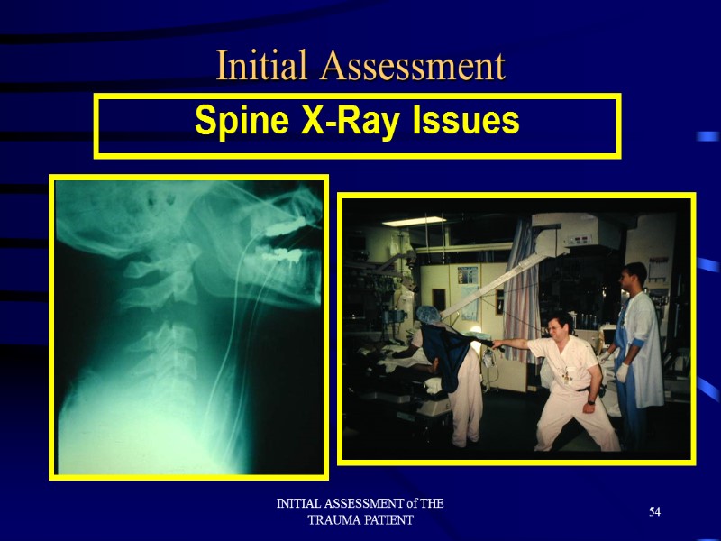 INITIAL ASSESSMENT of THE TRAUMA PATIENT 54 Initial Assessment Spine X-Ray Issues